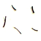 メディオスターNextPro「髭」の抜けた方