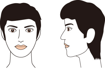 メディオスターヒゲ脱毛完了後