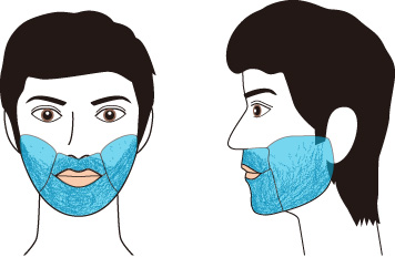 メディオスター髭脱毛効果範囲図【ほほ・もみあげ】追加
