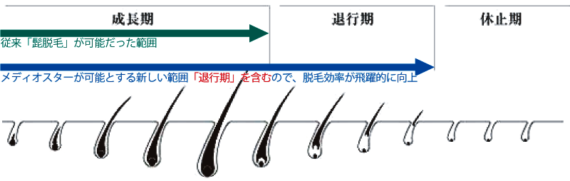 メディオスターの髭脱毛と毛周期期間と回数の図解